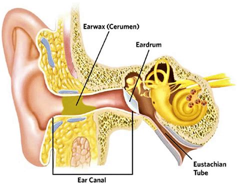 what is cerumen impaction